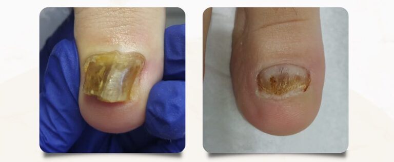 Antes e depois · Marafigo Clínica Integrativa — clinica de estetica em Centro, São José dos Pinhais - PR