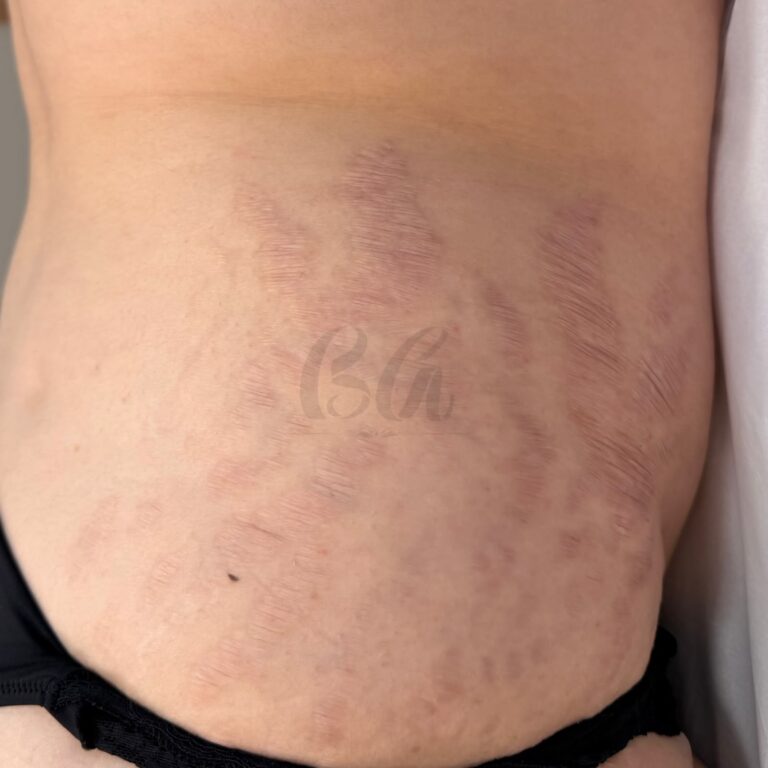 Estética corporal · Marafigo Clínica Integrativa — clinica de estetica em Centro, São José dos Pinhais - PR
