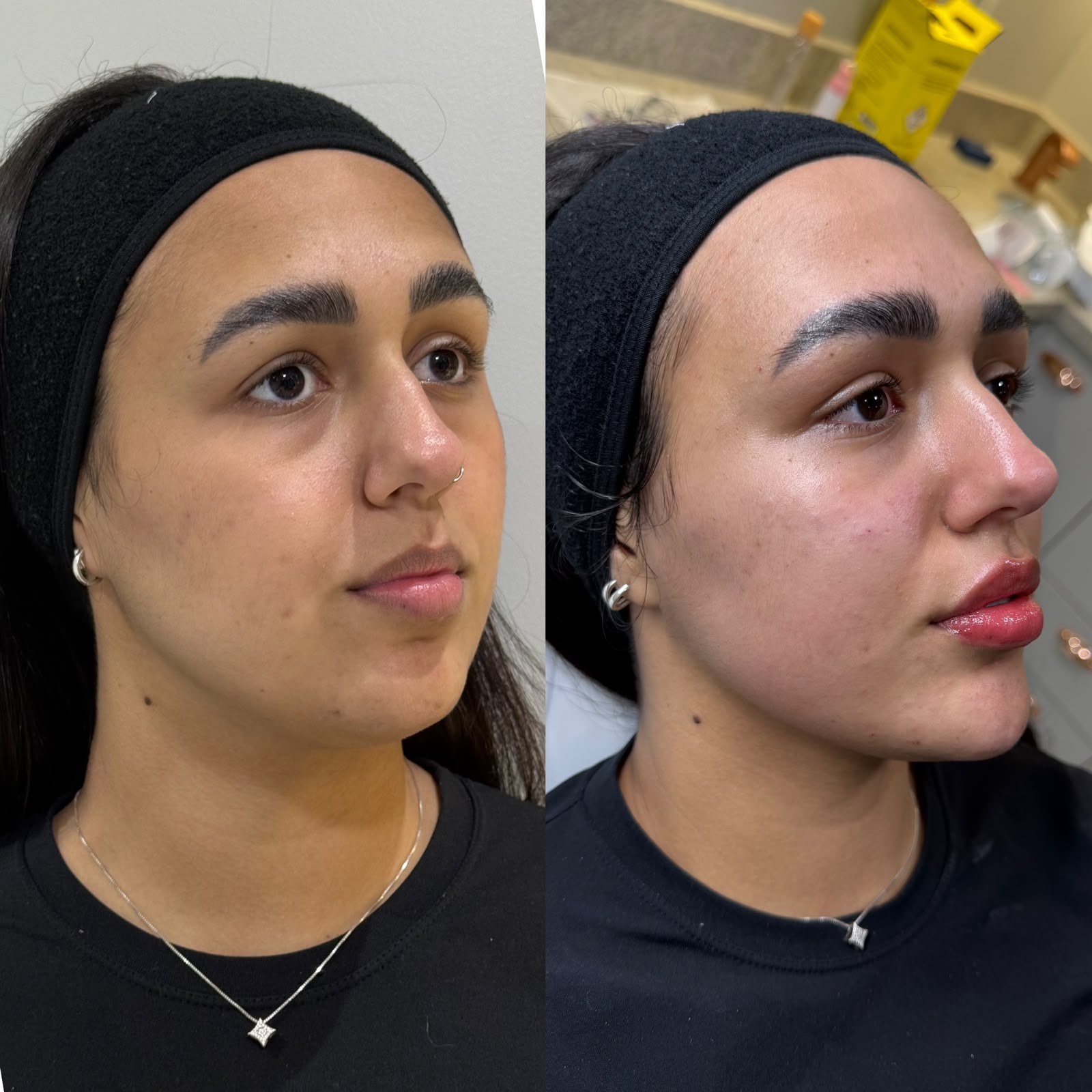 Nossa harmonização facial · Marafigo Clínica Integrativa